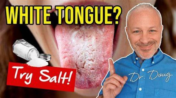 Does Salt Under Tongue Help ED? A Comprehensive Guide to Understanding This Unconventional Remedy